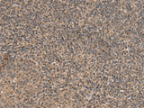 Immunohistochemistry of paraffin-embedded Human tonsil tissue using HEBP2 Polyclonal Antibody at dilution of 1:70(×200)
