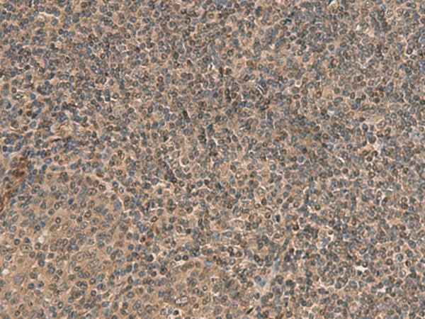Anti-Human/Mouse HEBP2 Antibody