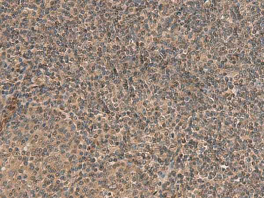 Anti-Human/Mouse HEBP2 Antibody