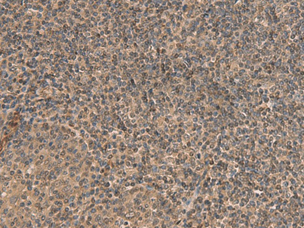 Immunohistochemistry of paraffin-embedded Human tonsil tissue using HEBP2 Polyclonal Antibody at dilution of 1:70(×200)