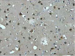 Immunohistochemistry of paraffin-embedded Human brain tissue using MAP2 Monoclonal Antibody at dilution of 1:200.