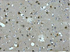 Immunohistochemistry of paraffin-embedded Human brain tissue using MAP2 Monoclonal Antibody at dilution of 1:200.