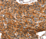 Anti-Human/Mouse/Rat TRIM69 Antibody - ABMIUM