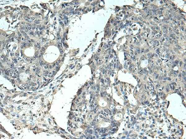 Anti-Human/Mouse/Rat SLC35F6 Antibody