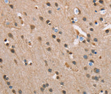 Anti-Human SERPINA1 Antibody - ABMIUM