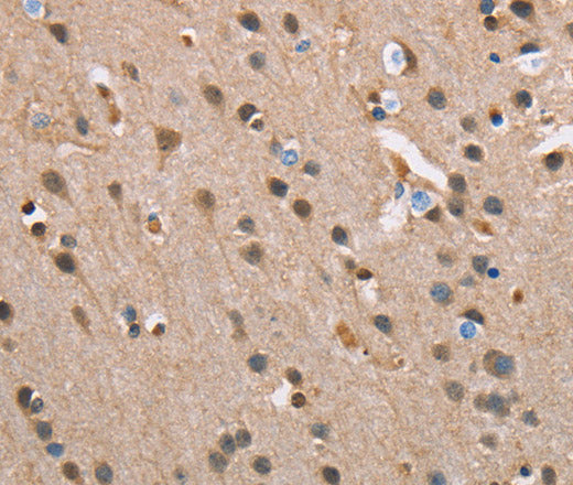 Anti-Human SERPINA1 Antibody - ABMIUM