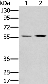 Anti-Human PGBD2 Antibody - ABMIUM