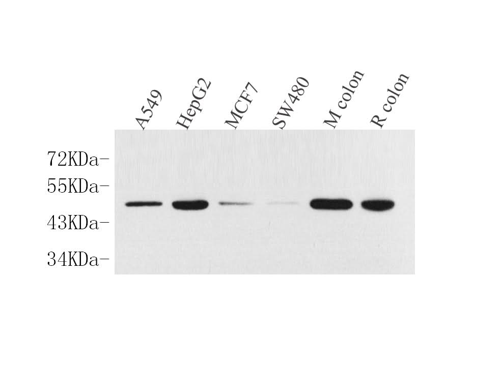 Western Blot analysis of various samples using CK-18 Polyclonal Antibody at dilution of 1:1000.