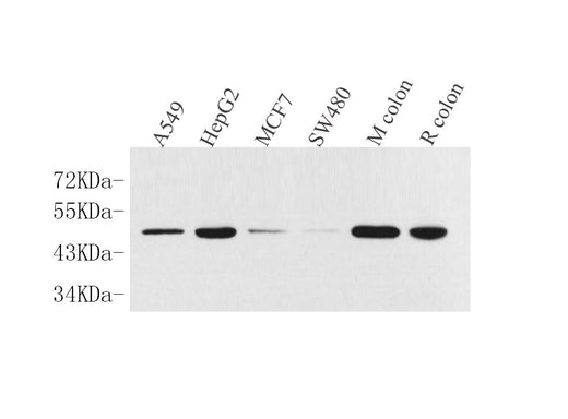 Western Blot analysis of various samples using CK-18 Polyclonal Antibody at dilution of 1:1000.