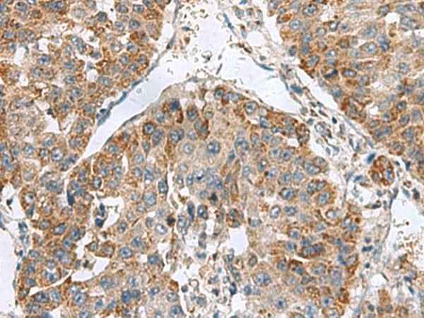 Anti-Human NFS1 Antibody
