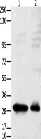Anti-Human/Mouse GNRHR Antibody - ABMIUM