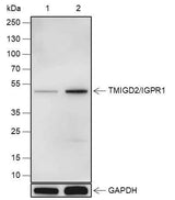 Anti-Human TMIGD2/IGPR1 Antibody [A551]