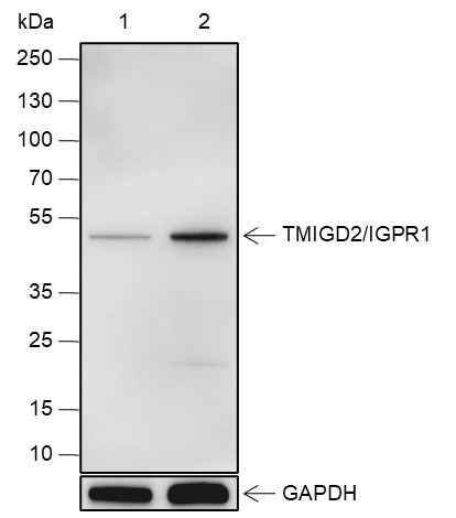 Anti-Human TMIGD2/IGPR1 Antibody [A551]