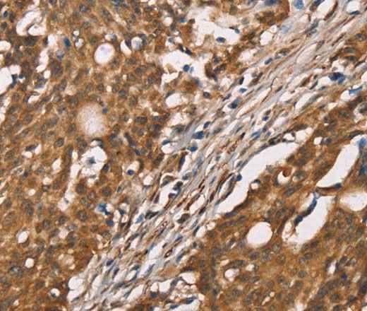 Anti-Human/Mouse DICER1 Antibody