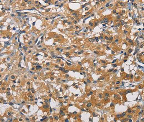 Anti-Human/Mouse PIKFYV Antibody