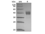 Recombinant Rhesus Macaque Tumor-associated Calcium Signal Transducer 2/TROP-2 (C-6His) - ABMIUM