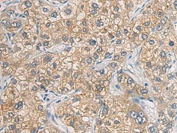 Anti-Human GAB4 Antibody
