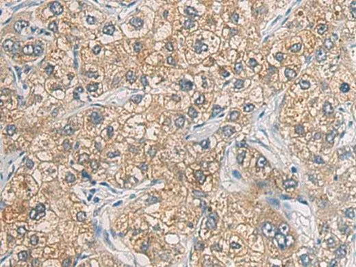 Anti-Human GAB4 Antibody