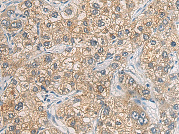 Anti-Human GAB4 Antibody - ABMIUM