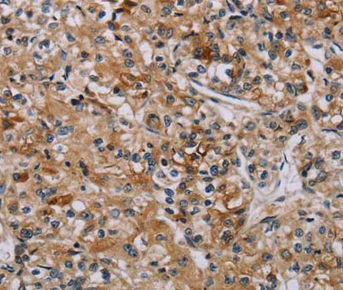 Anti-Human/Mouse AATK Antibody