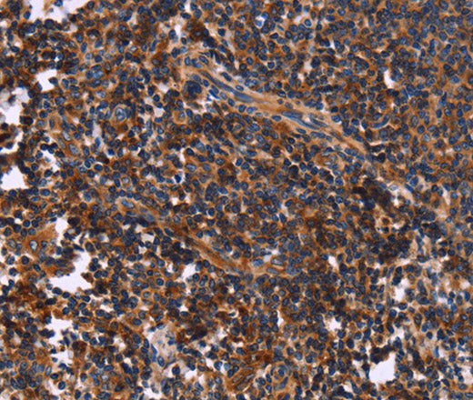 Anti-Human/Mouse/Rat SYT4 Antibody - ABMIUM
