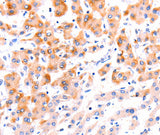 Anti-Human/Mouse/Rat Ephrin A1 Antibody - ABMIUM