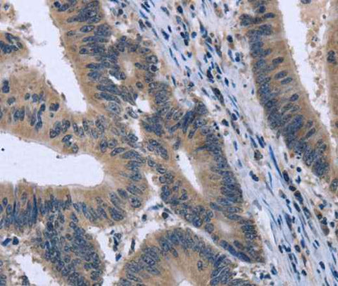 Anti-Human/Mouse/Rat KCNJ11 Antibody
