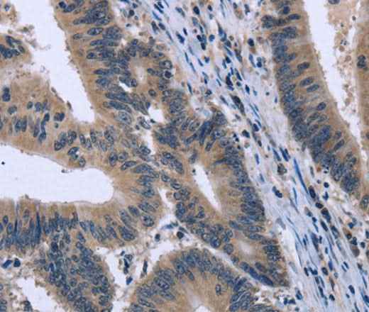 Anti-Human/Mouse/Rat KCNJ11 Antibody