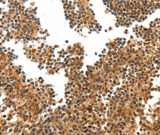 Anti-Human TERT Antibody - ABMIUM