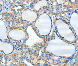 Anti-Human/Mouse HID1 Antibody - ABMIUM