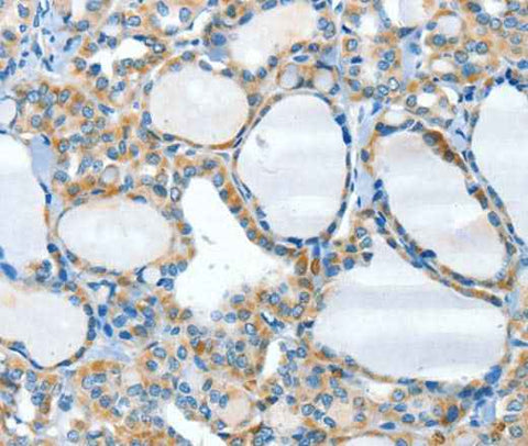 Anti-Human/Mouse HID1 Antibody