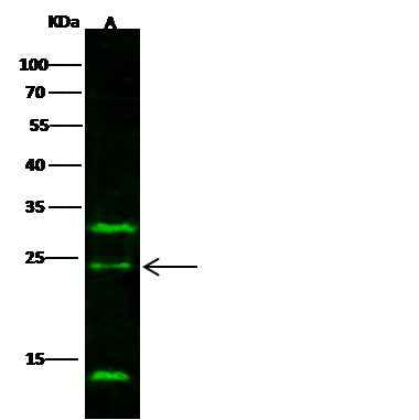 Anti-Human IL32 Antibody [A1053] - ABMIUM