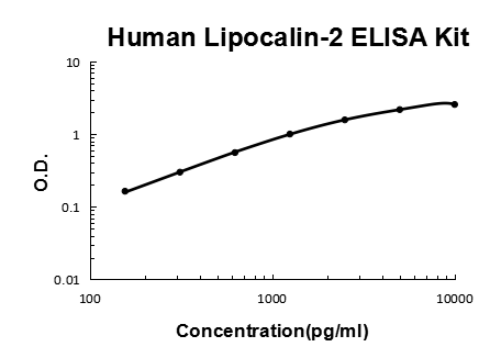 Human Lipocalin-2/NGAL PicoKine® Quick ELISA Kit Boster Bio