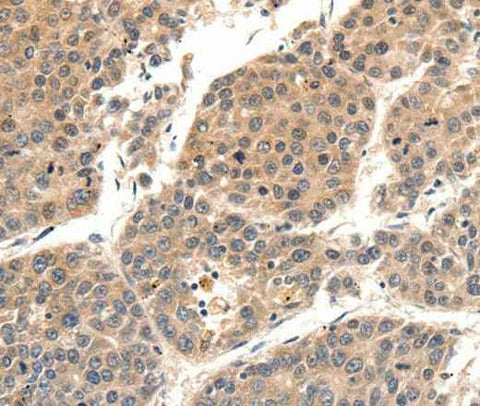 Anti-Human SLC27A1 Antibody