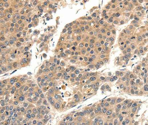 Anti-Human SLC27A1 Antibody