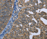 Anti-Human/Mouse/Rat GPAM Antibody - ABMIUM