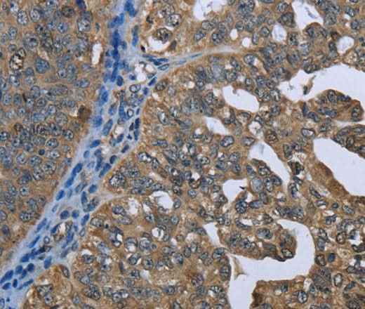 Anti-Human/Mouse/Rat GPAM Antibody