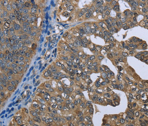Anti-Human/Mouse/Rat GPAM Antibody - ABMIUM