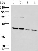 Western blot analysis of Rat brain tissue Mouse brain tissue Raji and 231 cell lysates using HTRA2 Polyclonal Antibody at dilution of 1:1000