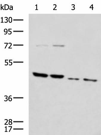 Western blot analysis of Rat brain tissue Mouse brain tissue Raji and 231 cell lysates using HTRA2 Polyclonal Antibody at dilution of 1:1000