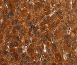 Anti-Human/Mouse ENTPD7 Antibody - ABMIUM