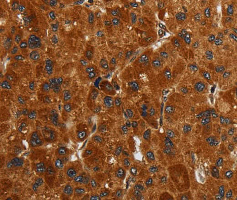 Anti-Human/Mouse ENTPD7 Antibody - ABMIUM