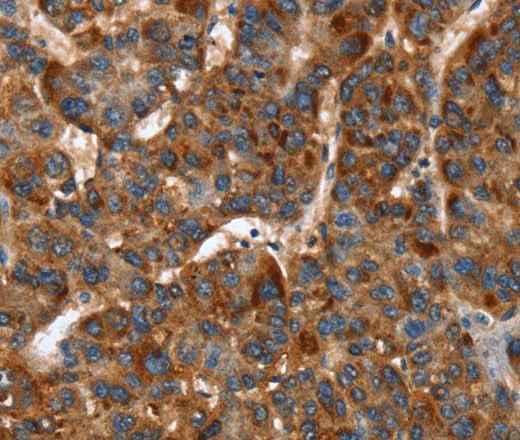 Anti-Human/Mouse/Rat CACNB2 Antibody