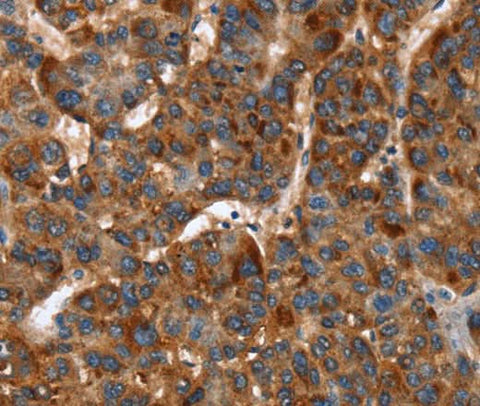 Anti-Human/Mouse/Rat CACNB2 Antibody - ABMIUM
