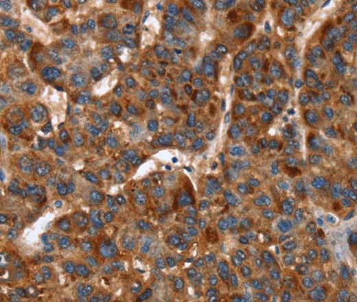 Anti-Human/Mouse/Rat CACNB2 Antibody - ABMIUM