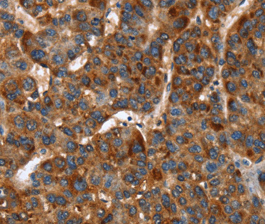 Anti-Human/Mouse/Rat CACNB2 Antibody - ABMIUM