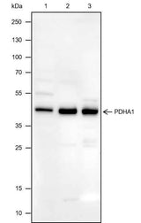 Anti-Human/Rat/Mouse PDHA1 Antibody [A520]
