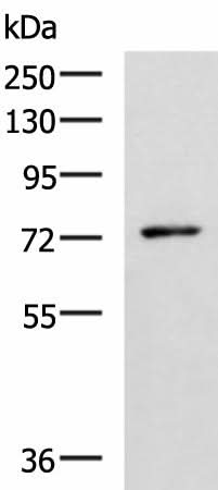 Western blot analysis of Mouse thymus tissue lysate using L3MBTL2 Polyclonal Antibody at dilution of 1:1000