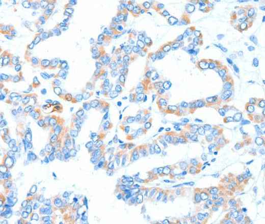 Anti-Human/Mouse/Rat GPT Antibody