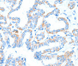 Anti-Human/Mouse/Rat GPT Antibody - ABMIUM